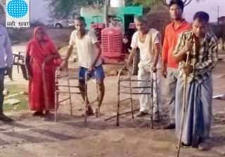 यहां 40 की उम्र में टूटने लगती हैं हडि्डयां:25 की उम्र में ही मुड़ने लगते हैं पैर; MP के इस गांव में रिश्तेदार भी नहीं रुकते